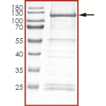 HER2 (L755S L869R), Active